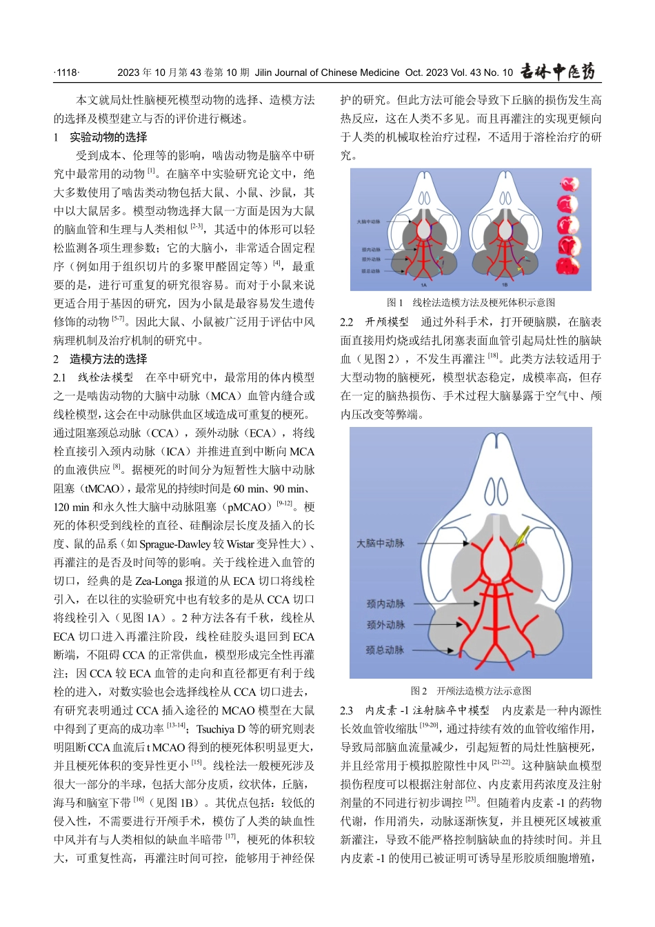局灶性脑缺血动物模型建立及评价概况.pdf_第2页