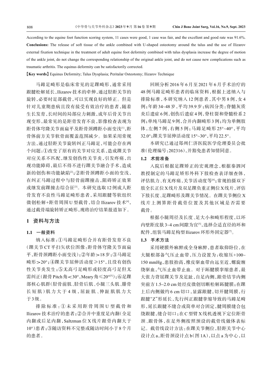距骨U型截骨结合Ilizarov技术治疗成人距骨发育不良性马蹄足畸形.pdf_第2页