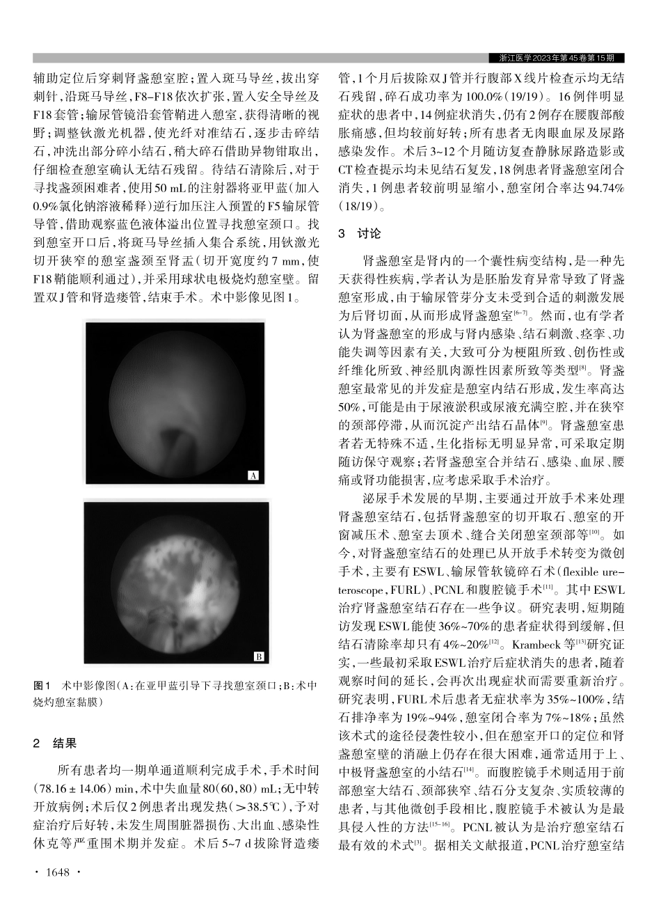 经皮肾镜碎石取石联合肾盏颈切开和憩室黏膜烧灼术治疗肾盏憩室结石的效果观察.pdf_第2页