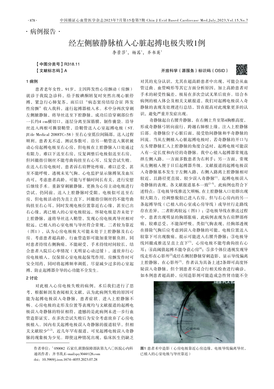 经左侧腋静脉植入心脏起搏电极失败1例.pdf_第1页