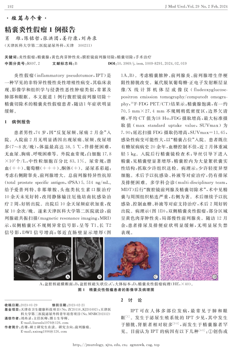精囊炎性假瘤1例报告.pdf_第1页