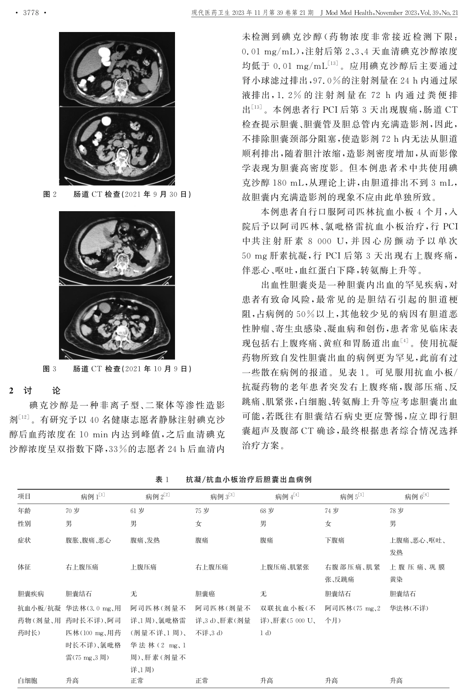 经皮冠状动脉介入治疗后胆囊内造影剂充盈合并急性胆囊炎1例.pdf_第3页