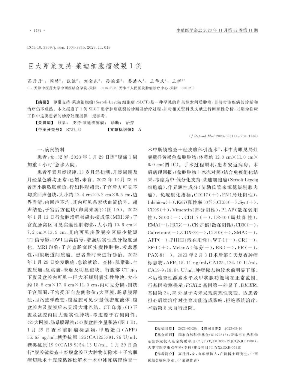 巨大卵巢支持-莱迪细胞瘤破裂1例.pdf_第1页