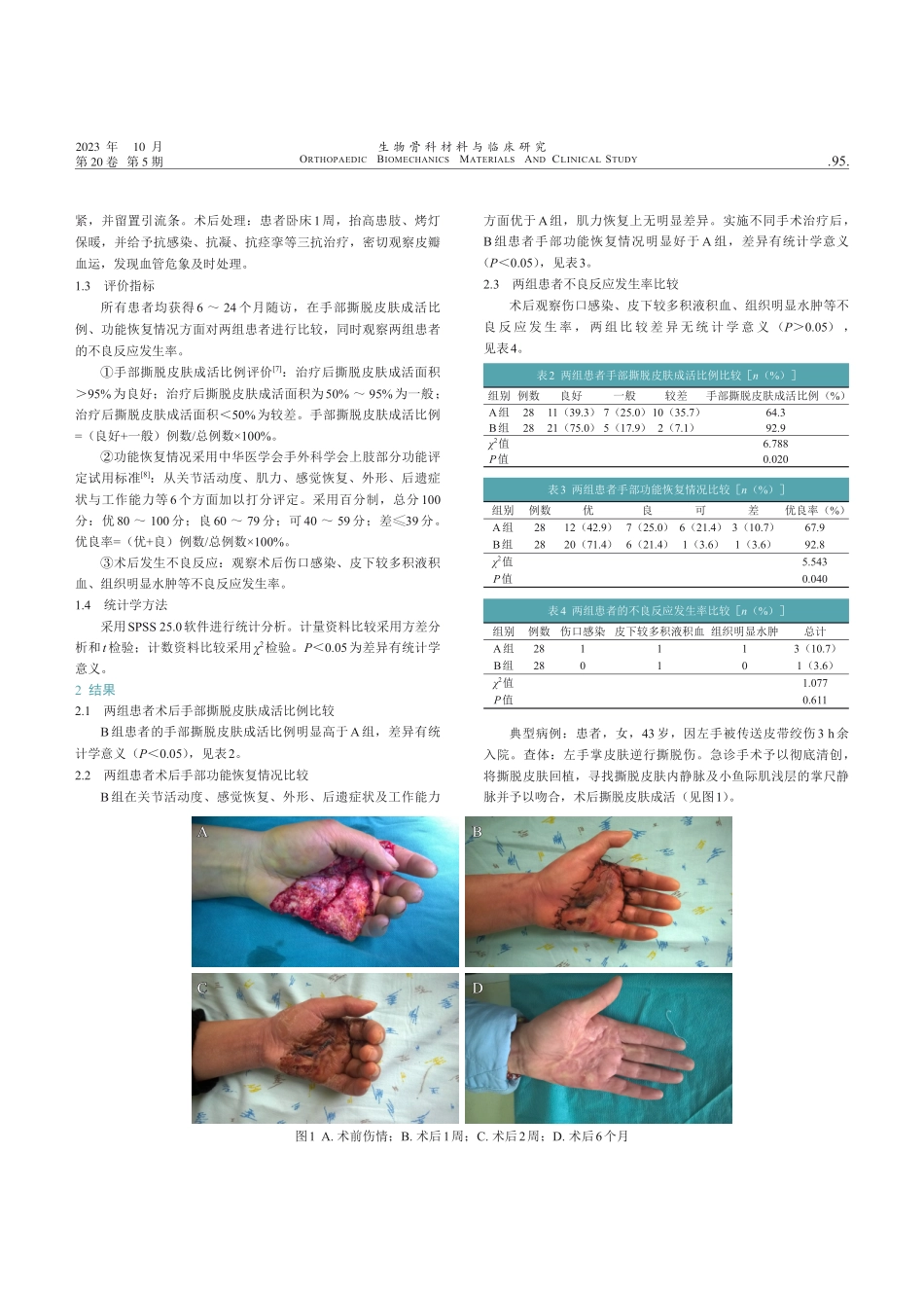 经显微镜下撕脱皮肤再回植联合掌尺静脉吻合治疗手掌皮肤逆行撕脱伤的应用研究.pdf_第2页
