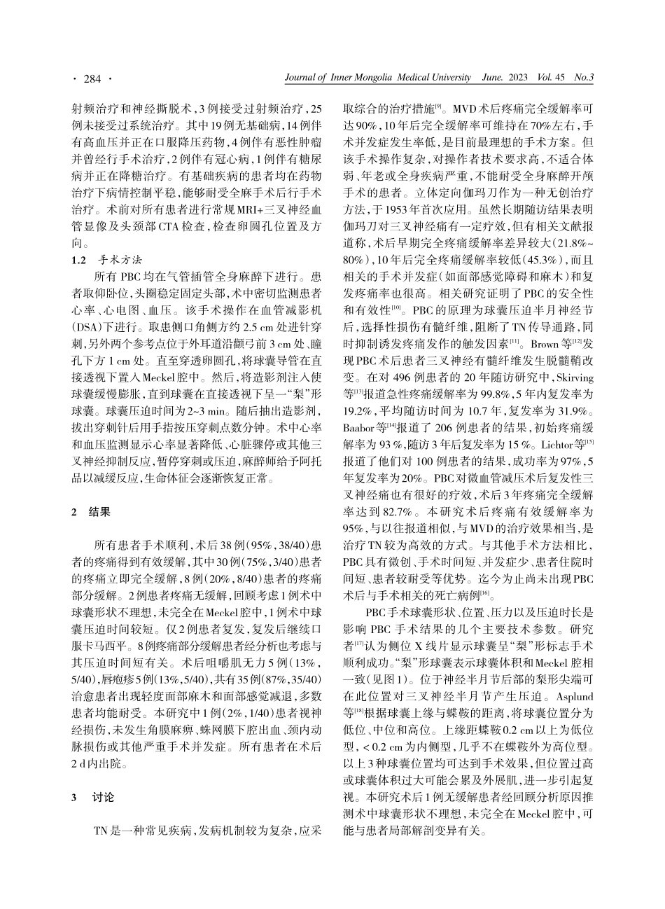 经皮三叉神经半月节球囊压迫术治疗三叉神经痛临床分析.pdf_第2页