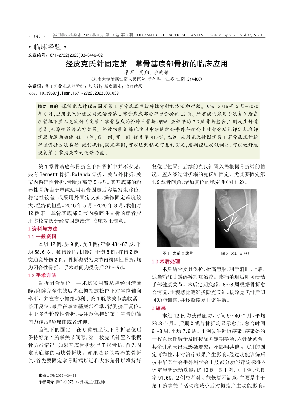 经皮克氏针固定第1掌骨基底部骨折的临床应用.pdf_第1页