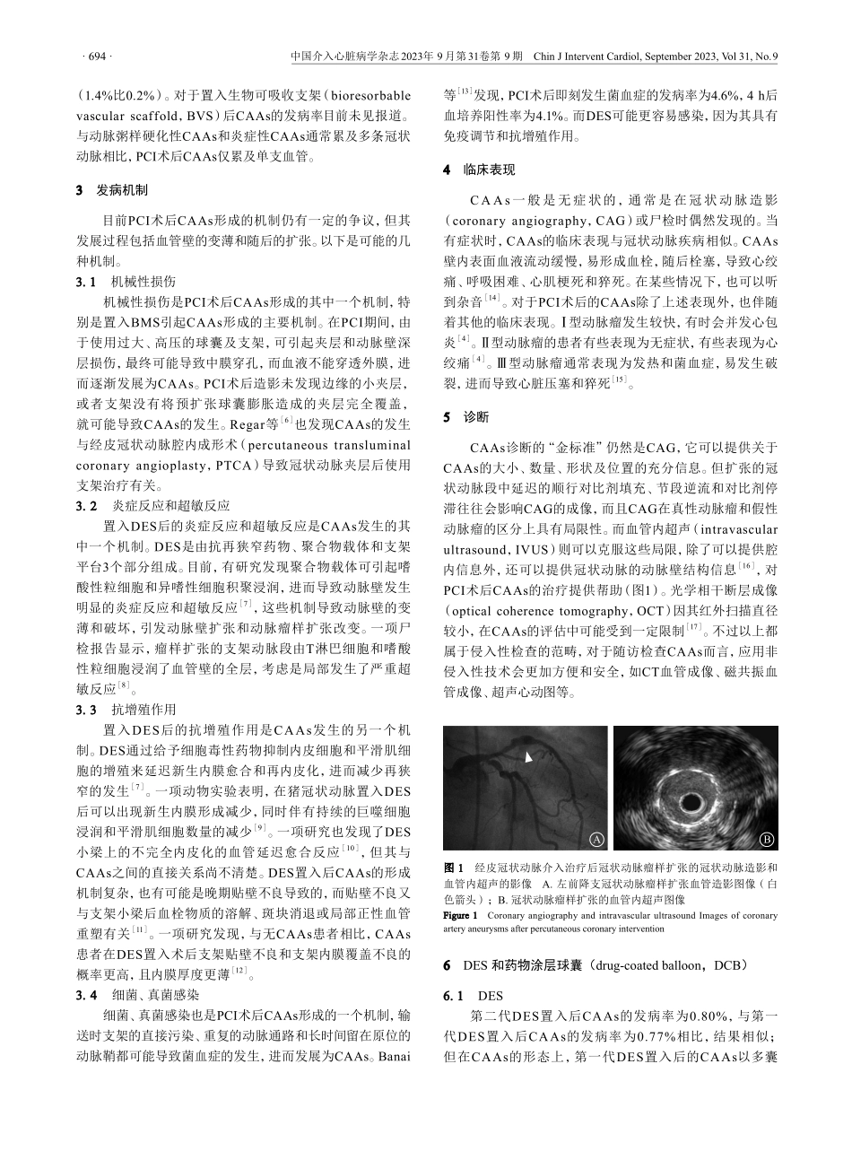 经皮冠状动脉介入治疗后冠状动脉瘤样扩张的研究.pdf_第2页