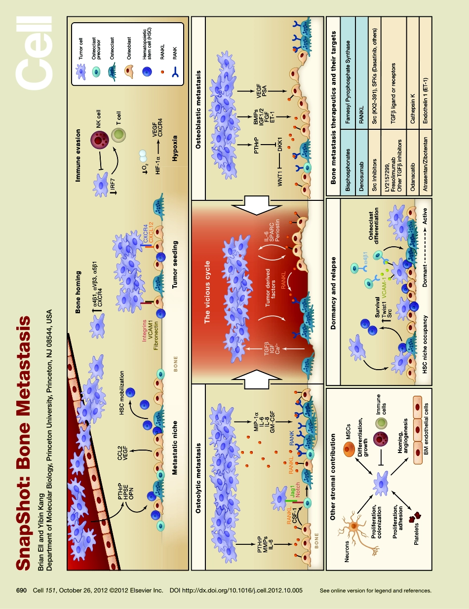 Bone Metastasis.pdf_第1页