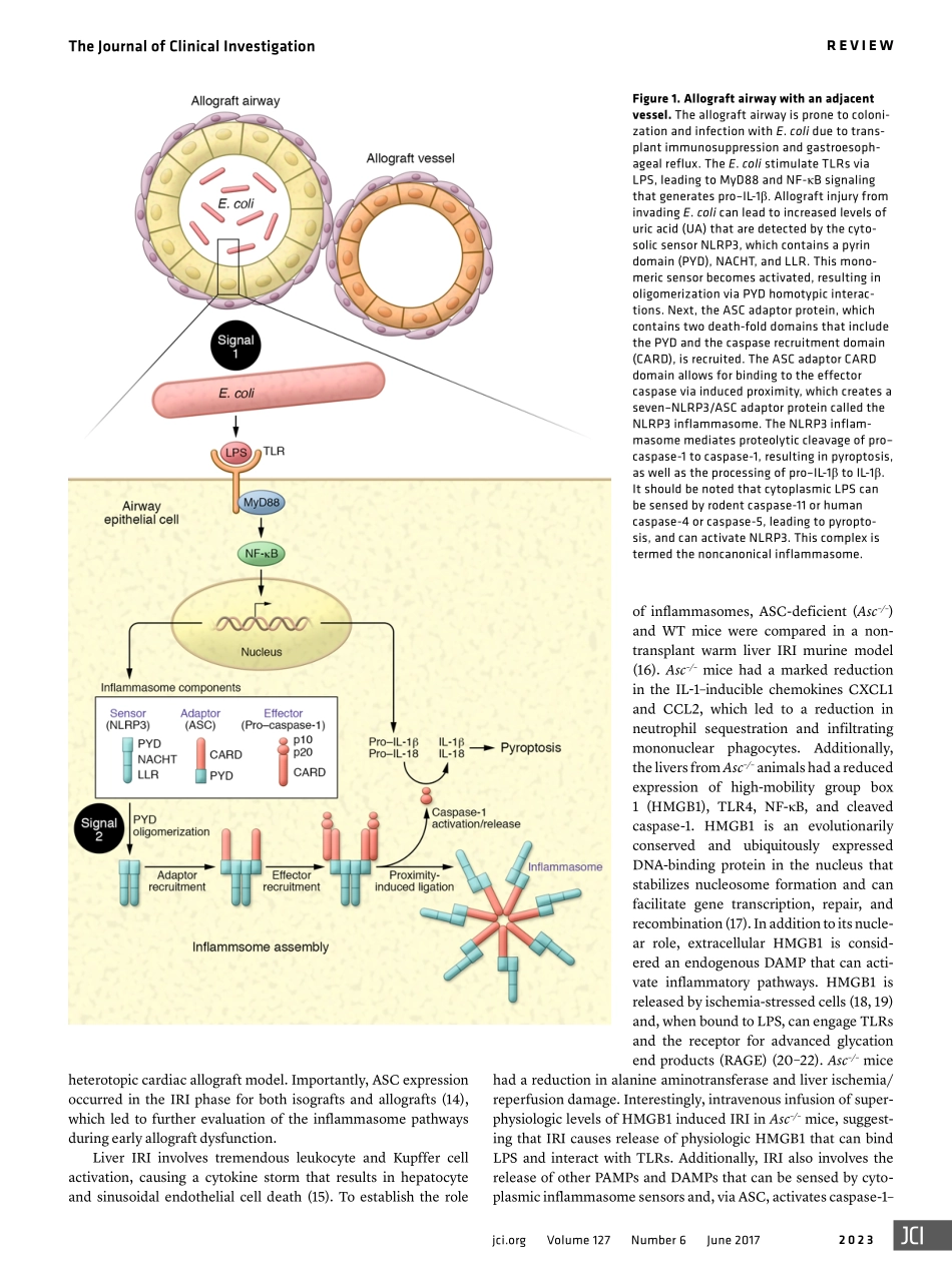 Inflammasomes and IL-1 biology in the pathogenesis of allograft dysfunction.pdf_第2页