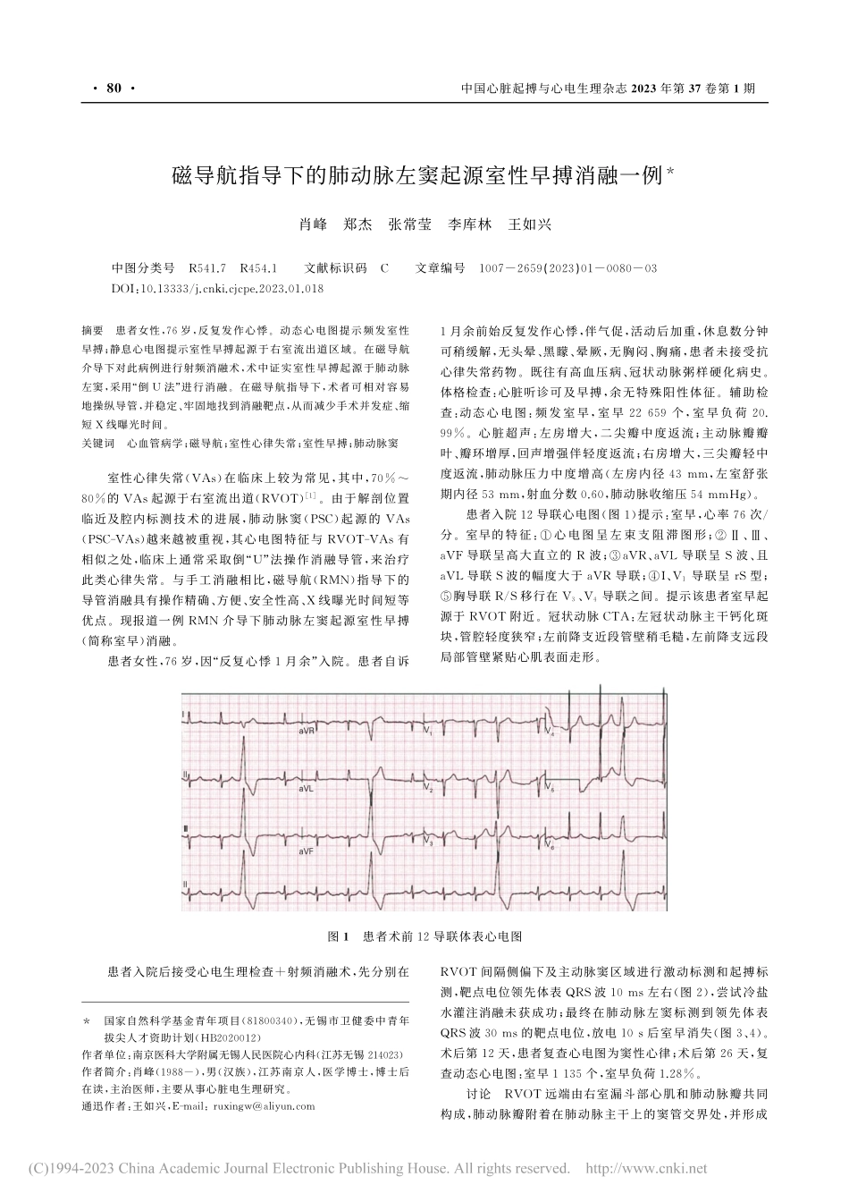 磁导航指导下的肺动脉左窦起源室性早搏消融一例_肖峰.pdf_第1页