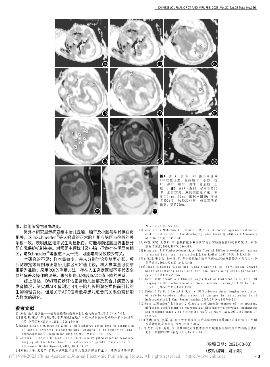 磁共振弥散加权成像对孕中晚期胎脑及其病变的诊断评估_陈芳芳.pdf_第3页