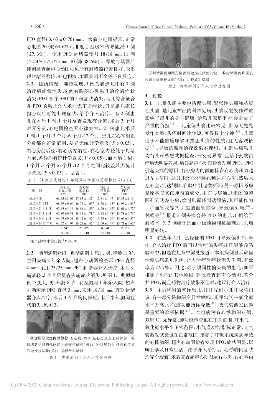 儿童卵圆孔未闭介入治疗21例临床分析_孙胜涛.pdf_第3页