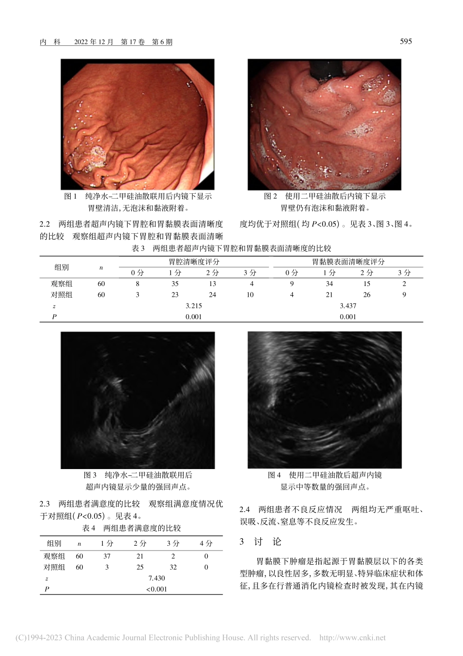 二甲硅油散和纯净水联用提高...超声内镜图像质量的效果研究_黄嘉岚.pdf_第3页