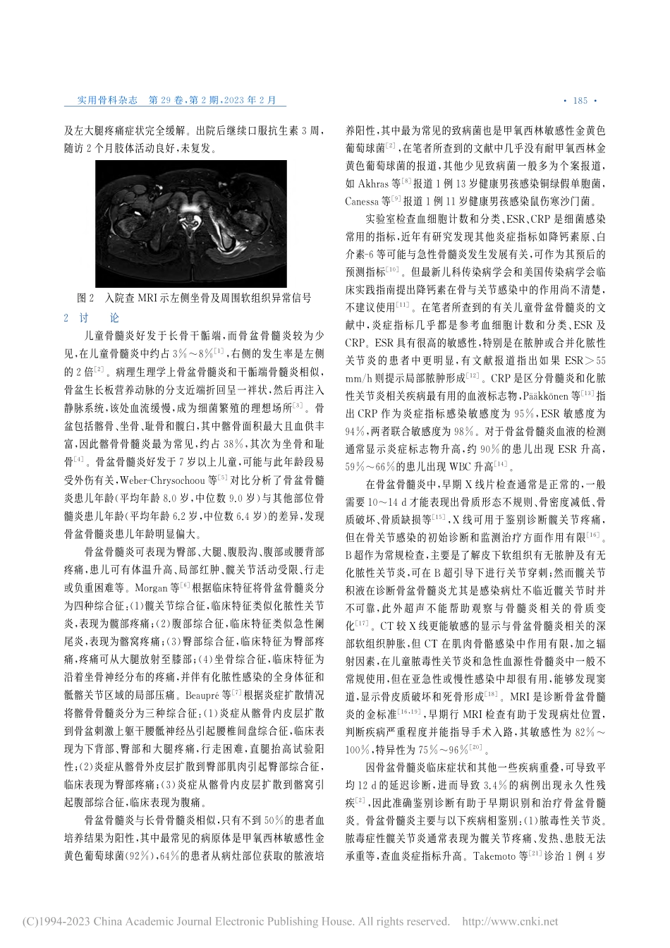 儿童骨盆骨髓炎2例报道并文献复习_贾海亭.pdf_第2页