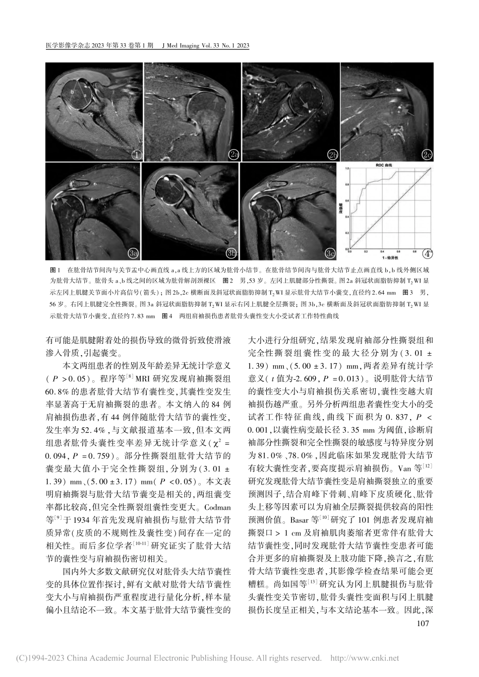 肱骨大结节囊性变与肩袖损伤程度的MRI相关性分析_罗小兰.pdf_第3页