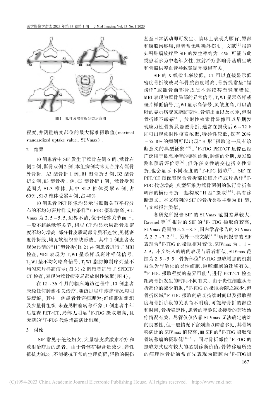 宫颈癌放疗后骶骨衰竭骨折的..._PET_CT图像特征分析_房娜.pdf_第2页