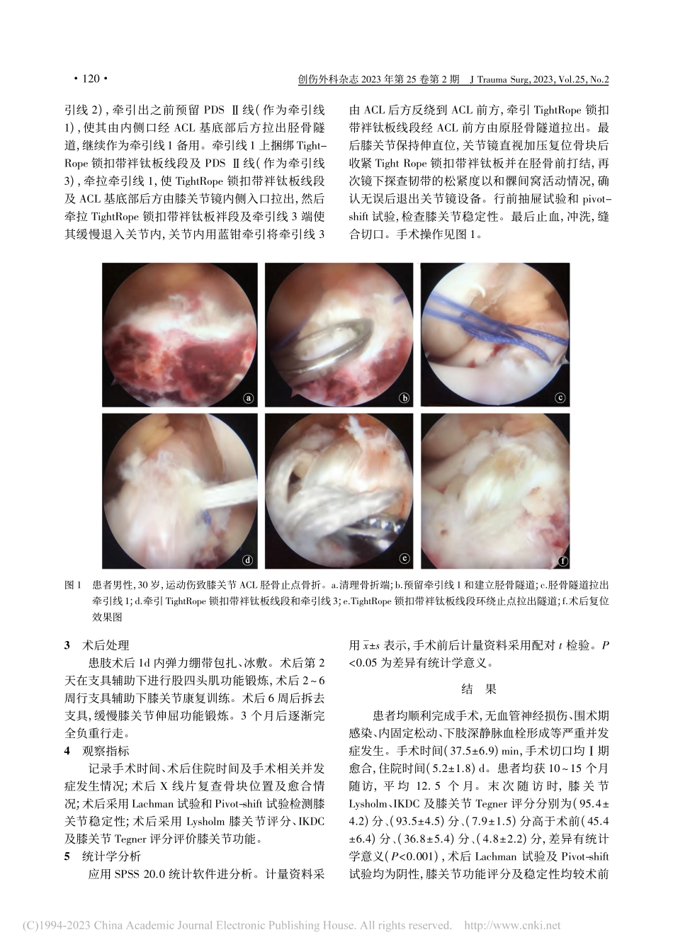 关节镜下TightRope...骨止点撕脱性骨折的疗效评估_陆军帅.pdf_第3页