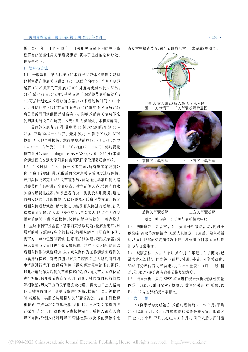 关节镜下360°关节囊松解治疗黏连性肩关节囊炎_王微.pdf_第2页